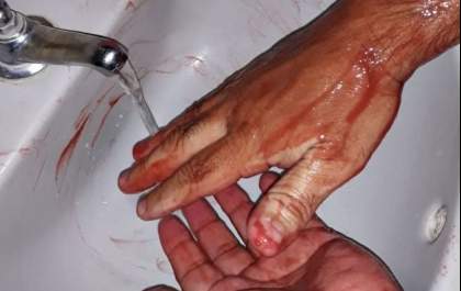 Discussão entre casal termina em agressão no Jardim das Orquídeas
