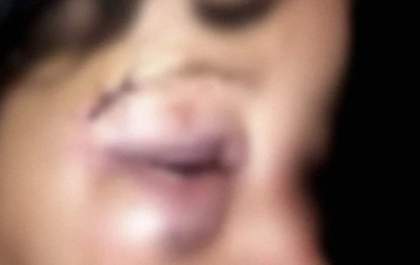 Marido espanca a esposa e diz à polícia que foi para impor respeito