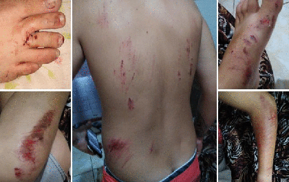 Motorista atropela mãe e filho e foge