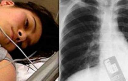 Mulher engole celular para namorado não ler as mensagens, é verdade ou mentira?