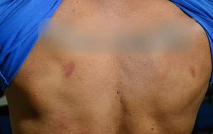 Bandidos batem nas costelas de homem com revólver durante assalto