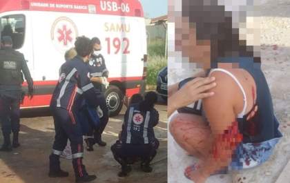 Homem e mulher sofrem tentativa de homicídio no Parque São Carlos