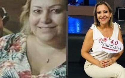 Jornalista e empresária perde 41 kg após bariátrica e ganha uma vida nova