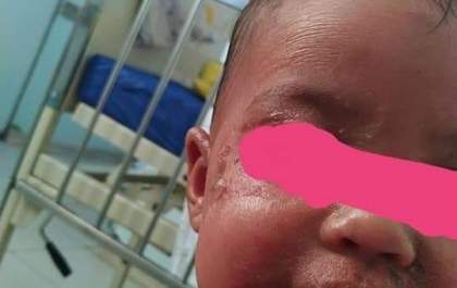 Desabafo de tia mostra fragilidade da saúde municipal em Castilho