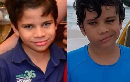 Garotinho de 10 anos precisa de ajuda para voltar a comer e sorrir