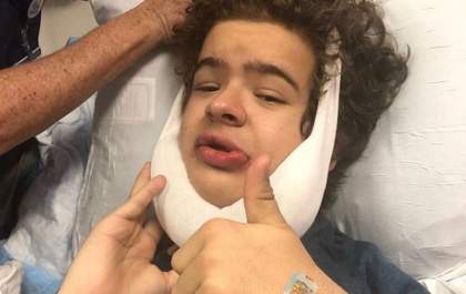Ator de 'Stranger Things' passa por cirurgia e remove 14 dentes