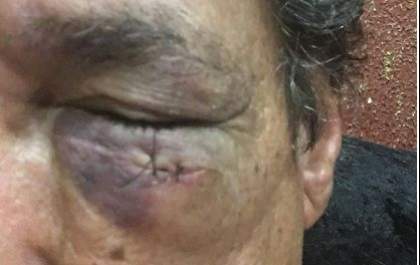 Comissão julga improcedente denúncia de quebra de decoro de vereador por cabeçada
