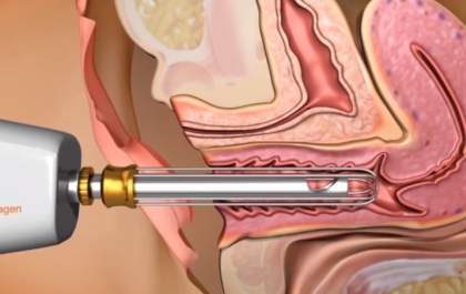 Cosmetoginecologia – a estética vaginal e a autoestima da mulher