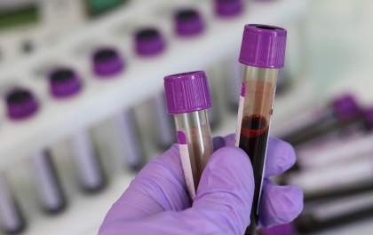 Saúde lança painel informativo sobre tratamento das hepatites B e C