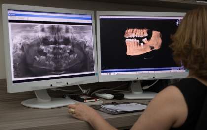Doc X Três Lagoas realiza documentação ortodôntica 100% digital