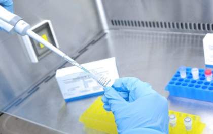 Testes rápidos ajudam diagnosticar casos suspeitos em Penápolis