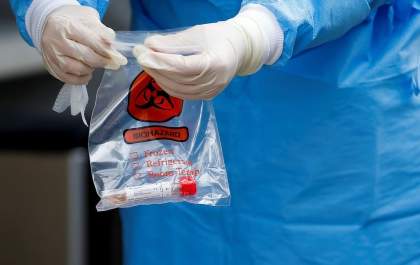 Covid-19: Brasil tem 553 mortes e 12 mil casos confirmado