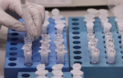 Coronavírus: MS registra 100 casos confirmados