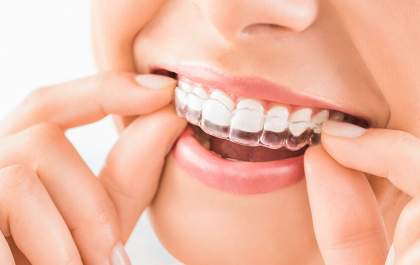 Clínica Bruzadin Odontologia inova e realiza tratamento com aparelho ortodôntico invisível !