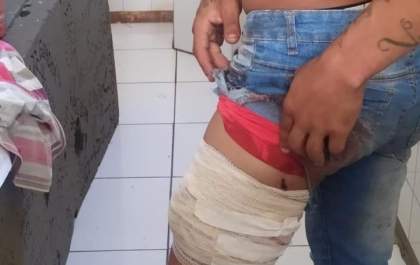 Homem é ferido em troca de tiros com a PM