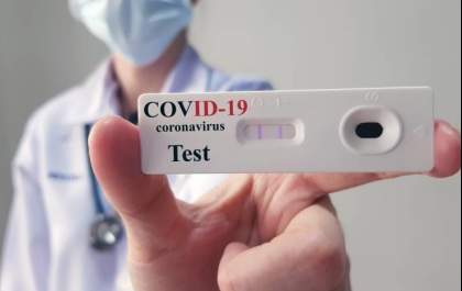 Teste rápido de coronavírus poderá ser realizado em farmácias