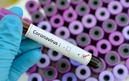 É falsa notícia de que existem mais de 100 casos de Coronavírus em TL