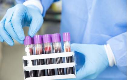 Covid-19: imunologista baiano está na linha de frente para criação da vacina contra a doença