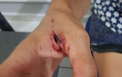 Homem é preso após invadir casa e esfaquear moradora no Interlagos