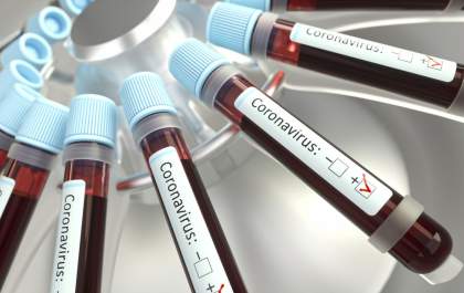 Dois países aprovaram medicamento antiviral contra a Covid-19