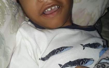 Família pede ajuda para comprar canabidiol para filho com microcefalia