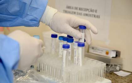 Brasil chega perto da marca de um milhão de casos confirmados da Covid-19