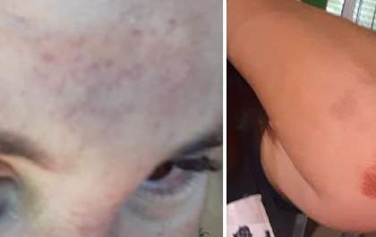 Cansada de apanhar, mulher denuncia ex nas redes sociais em Três Lagoas
