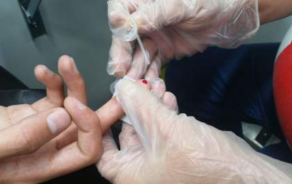 Birigui fará testagens rápidas para hepatites B e C