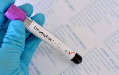 MS atinge mais de 16 mil casos confirmados de Covid-19