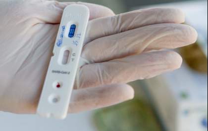 ANS retira teste para covid-19 de lista obrigatória de cobertura