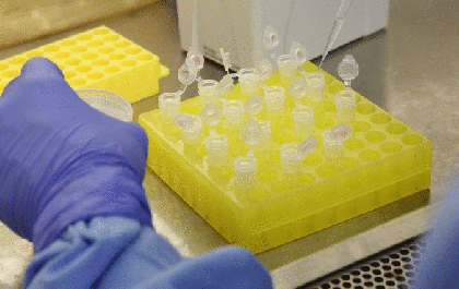 Covid infecta tecido do coração e modifica o órgão, dizem estudos
