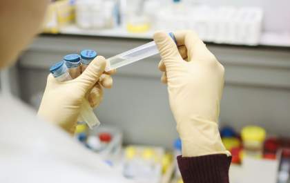 Convênio entre Unesp e laboratório permite testes rápidos em Araçatuba