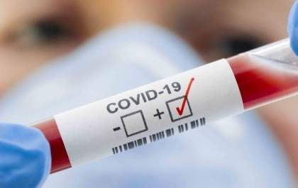 Três Lagoas tem 24 pessoas recuperadas da Covid-19 e 13 no novos casos nesta sexta-feira (14)