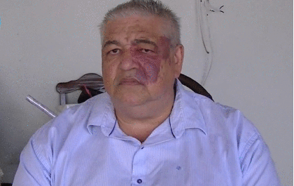 Denúncia aponta notas frias após conclusão de casas populares