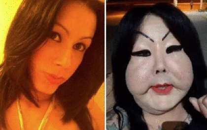 Transexual coloca silicone industrial no rosto e passa a sofrer bullying