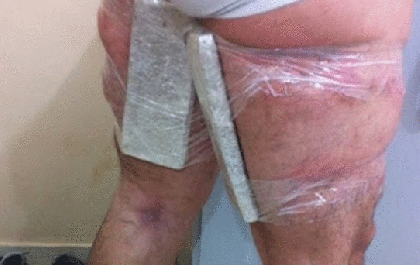 Mulher é presa carregando cocaína amarrada ao corpo