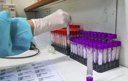 Covid-19: UFRJ desenvolve teste sorológico 20 vezes mais barato