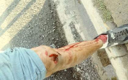 Homem cai com moto após enrocar em cabo pendurado na rua em Birigui