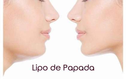 Equipe da Bruzadin Odontologia esclarece 5 dúvidas sobre a lipo de papada. Confira!