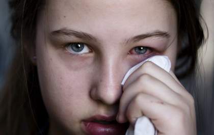 Herpes ocular, você sabe o que é? - Entenda mais sobre a doença