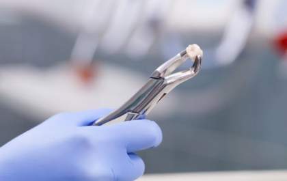Qual a hora certa para fazer a retirada dos dentes do siso? - Quem esclarece o assunto é a equipe da Crodonto TL