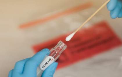 Com total de 74.839 casos, números de Covid no MS caem pelo segundo dia consecutivo