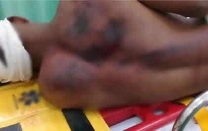 Adolescente é espancado em Andradina por padrasto com pedaço de madeira ao entrar em briga para defender mãe
