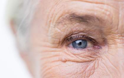 Catarata nos olhos, qual a hora certa para operar?- Quem esclarece o assunto é equipe médica do IOTL