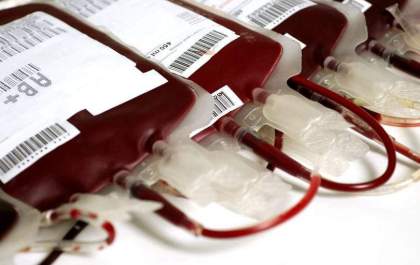 Banco de Sangue: déficit nos estoques chega a 35% em Araçatuba&nbsp;