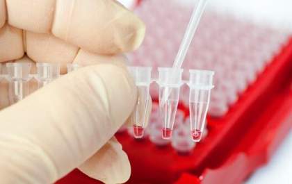 Araçatuba não terá exames de genotipagem em dezembro