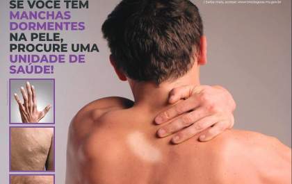 Saúde de Três Lagoas orienta população sobre importância do diagnóstico e prevenção da Hanseníase