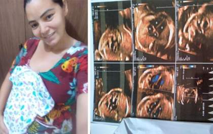 Grávida de 31 semanas descobre que bebê tem má formação no coração e pede ajuda para tratamento