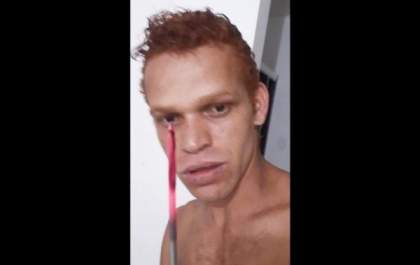 Homem grava vídeo queimando cachorro da ex-esposa e cena de horror choca as redes sociais