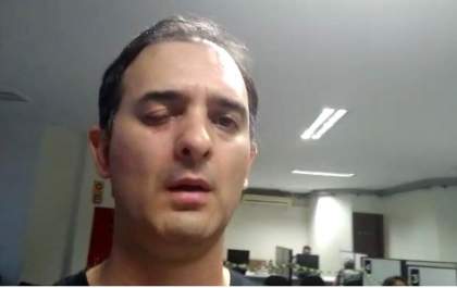 Homem leva soco no rosto por não estar de máscara em posto de saúde